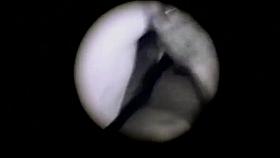 Laura Gemser, Barbara Rey - El periscopio