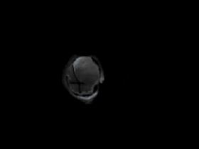 Teresa Vera Meneses banandose