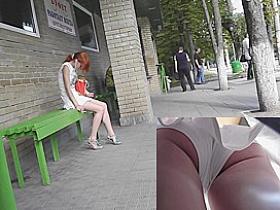 Pimples on legs seen on upskirt closeups