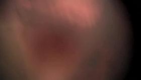 Cutest upskirt of the teenager wearing a short outfit