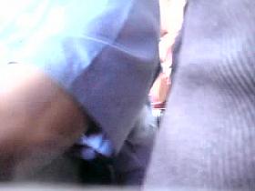 ENCOXADA ARRIMON IN THE ARM NURSE