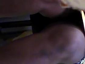 Upskirt at Dentist office